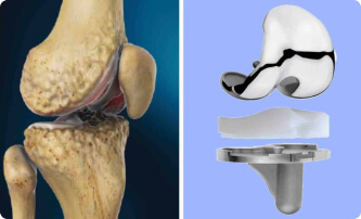 Imagem ilustrativa da notícia: Como é realizada a cirurgia?