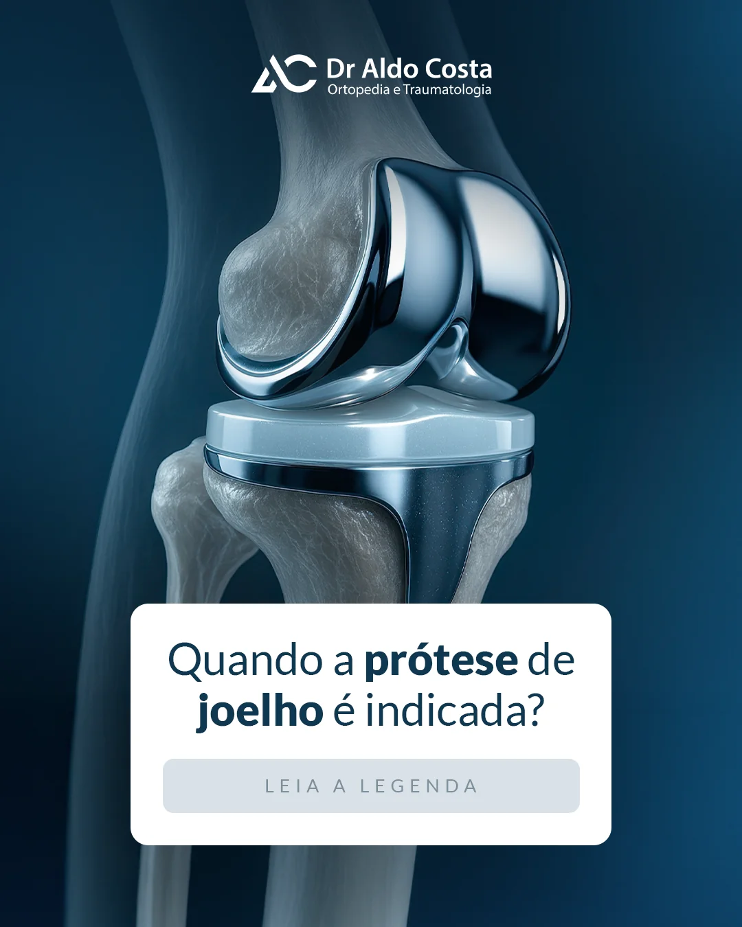 Imagem ilustrativa da notícia: Quando a prótese de joelho é indicada?