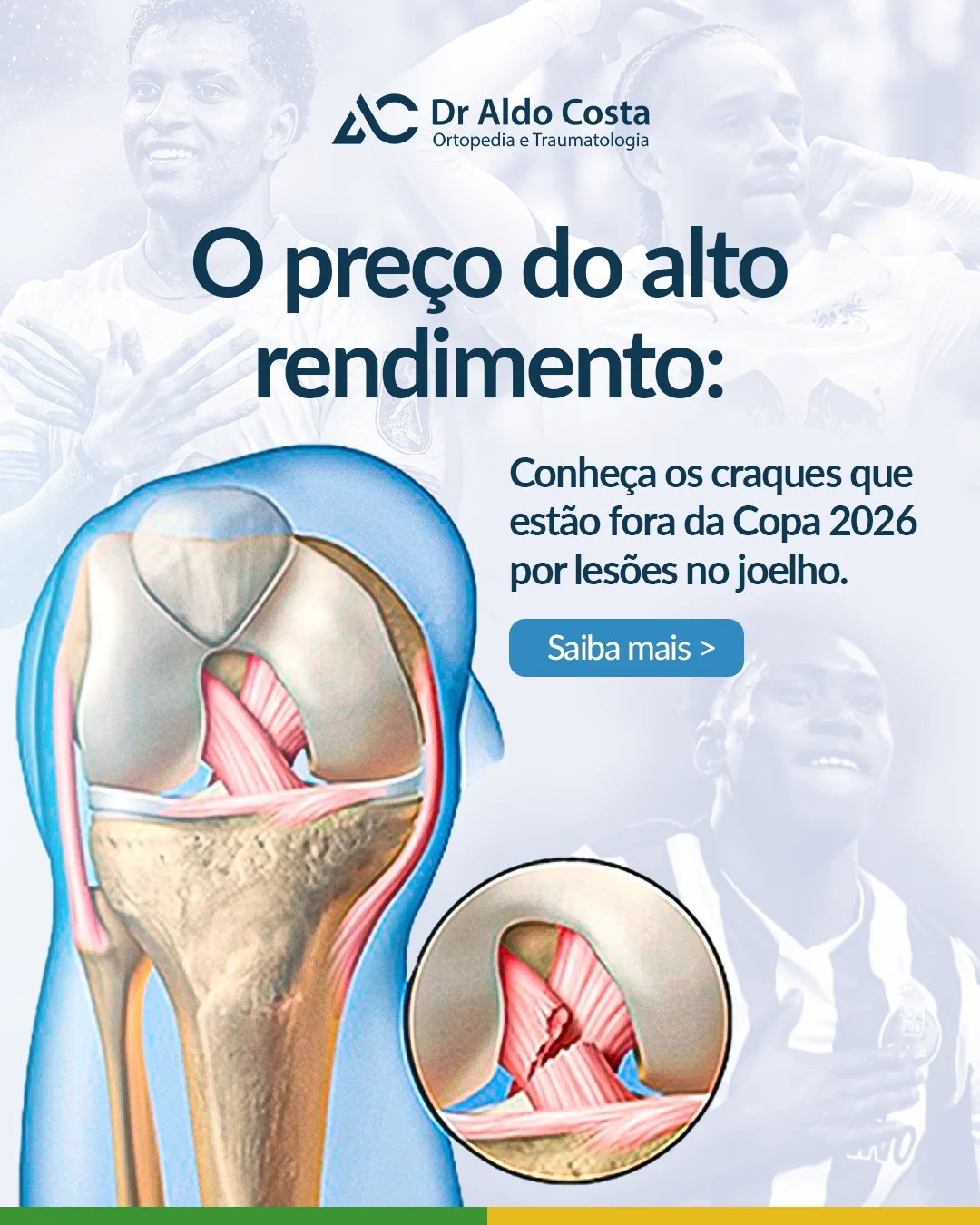 Imagem ilustrativa da notícia: O preço do alto rendimento: Conheça os craques que estão fora da Copa 2026 por lesões no joelho